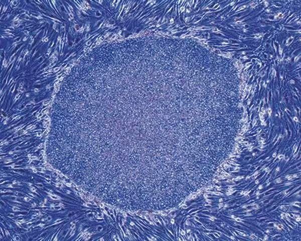 Induced pluripotent stem cell colony